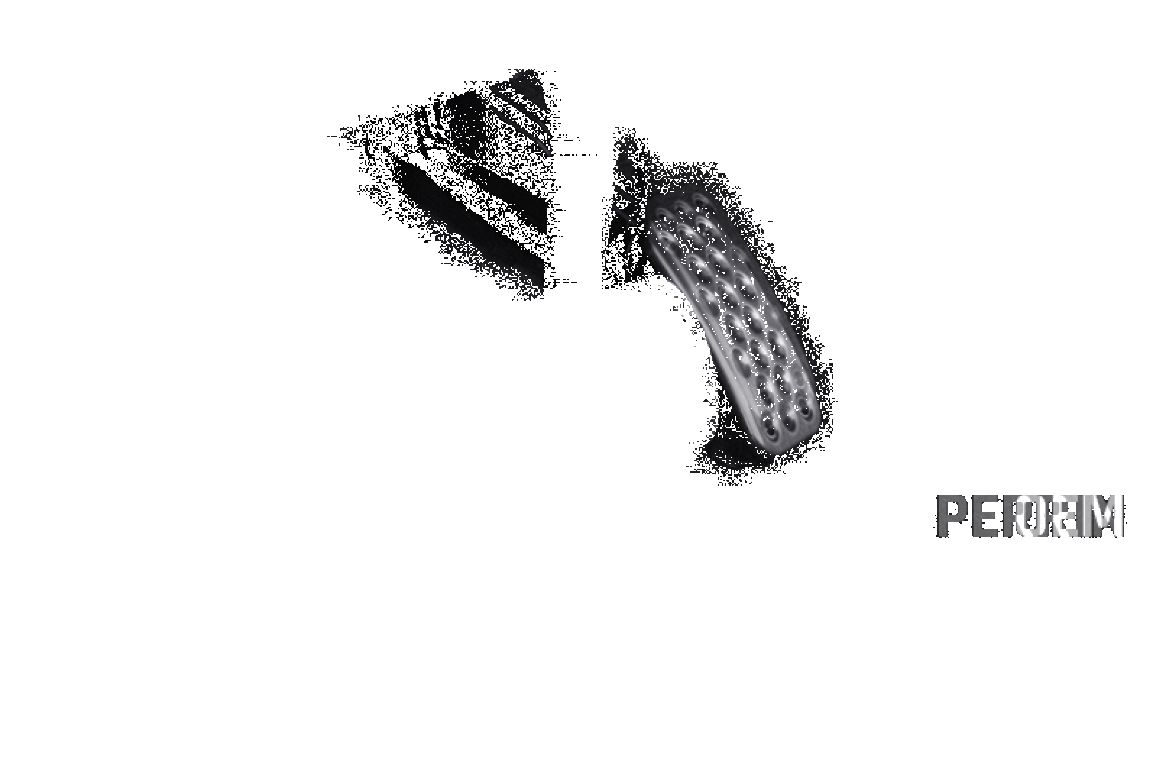 Perrin 17-19 Honda Civic Si / Type R Accelerator Pedal Relocate